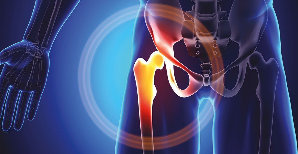 Orthopaedic Surgery - Hip and Knee | Specialities & Treatments at Parkside Suite Wexham