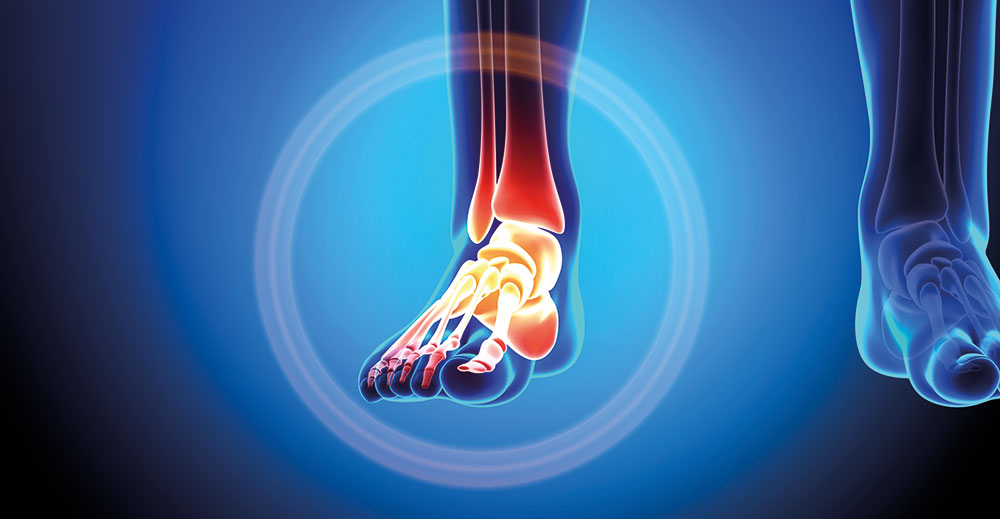 Orthopaedic Surgery - Foot and Ankle | Specialities & Treatments at Parkside Suite Wexham